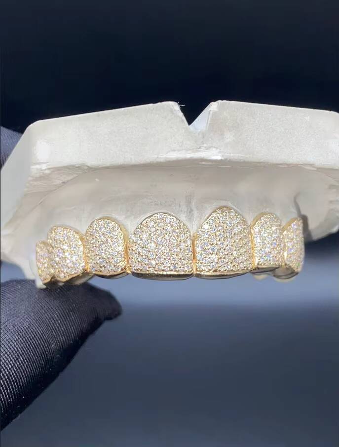 10K VVS Moissanite Grills Large Centre Stones Custom Grillz London Based Perfect Fit 8 Top 8 Bottom Fully Iced Out Grillz