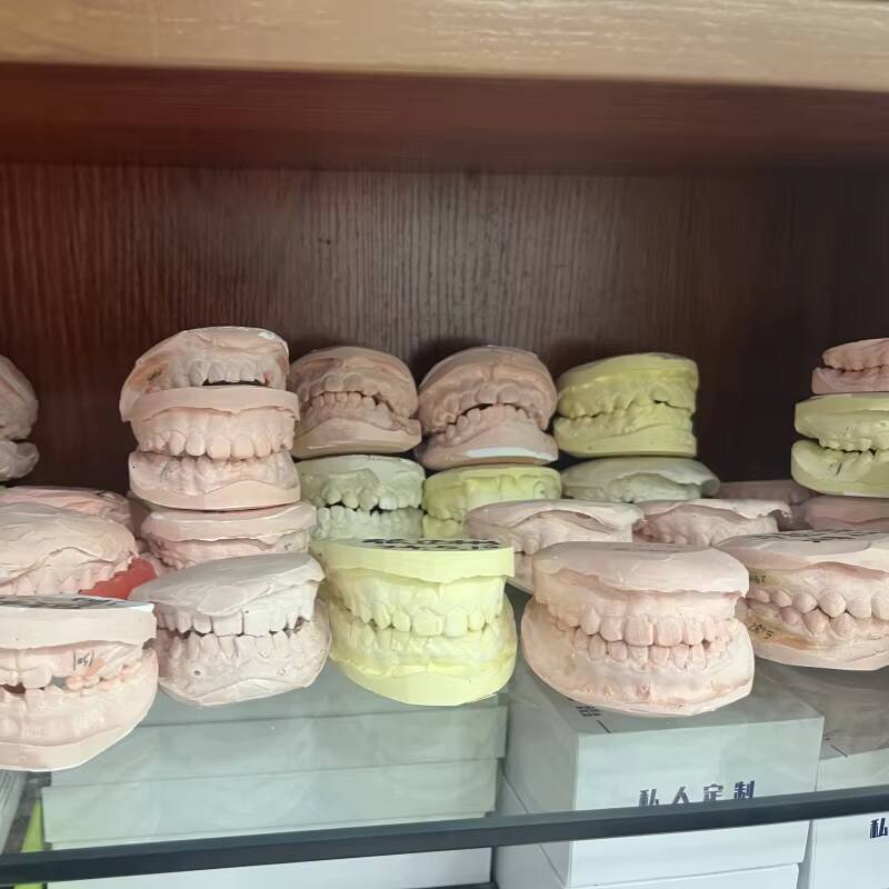 Fashion Hip Hop Jewelry Moissanite Grills Custom Rose Gold Plated 925 Silver Iced Out VVS Moissanite Diamond Teeth Grillz