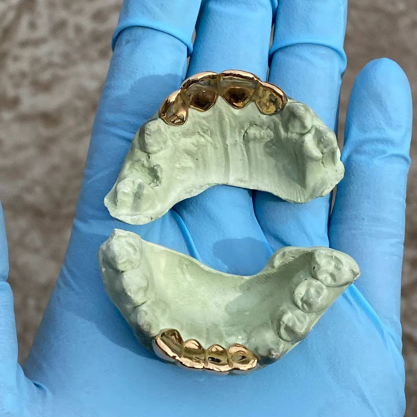 Real Solid 22K Gold Custom Grillz Teeth Grill or Single One Tooth Cap 4 Top and 4 Bottom Moissanite Diamond Teeth Grillz for Men