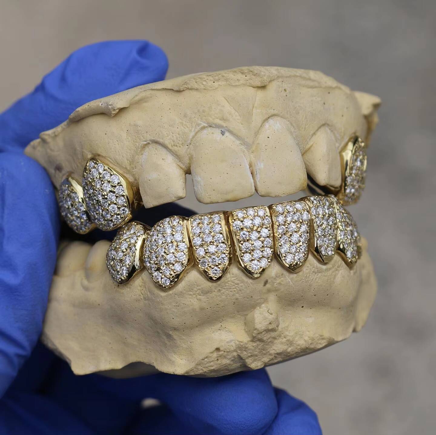 2023 New Wholesale Mens Hip Hop Gold Teeth Silver 925 Grillz Top Bottom Iced Out Grillz Dental Moissanite Grill