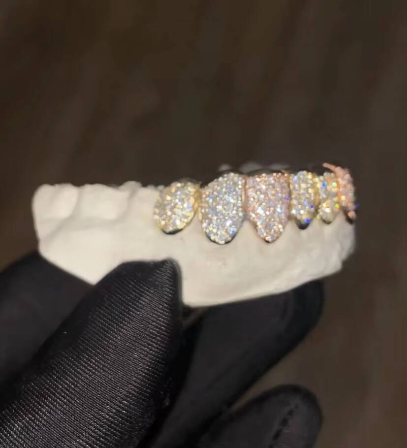 10K VVS Moissanite Grills Large Centre Stones Custom Grillz London Based Perfect Fit 8 Top 8 Bottom Fully Iced Out Grillz