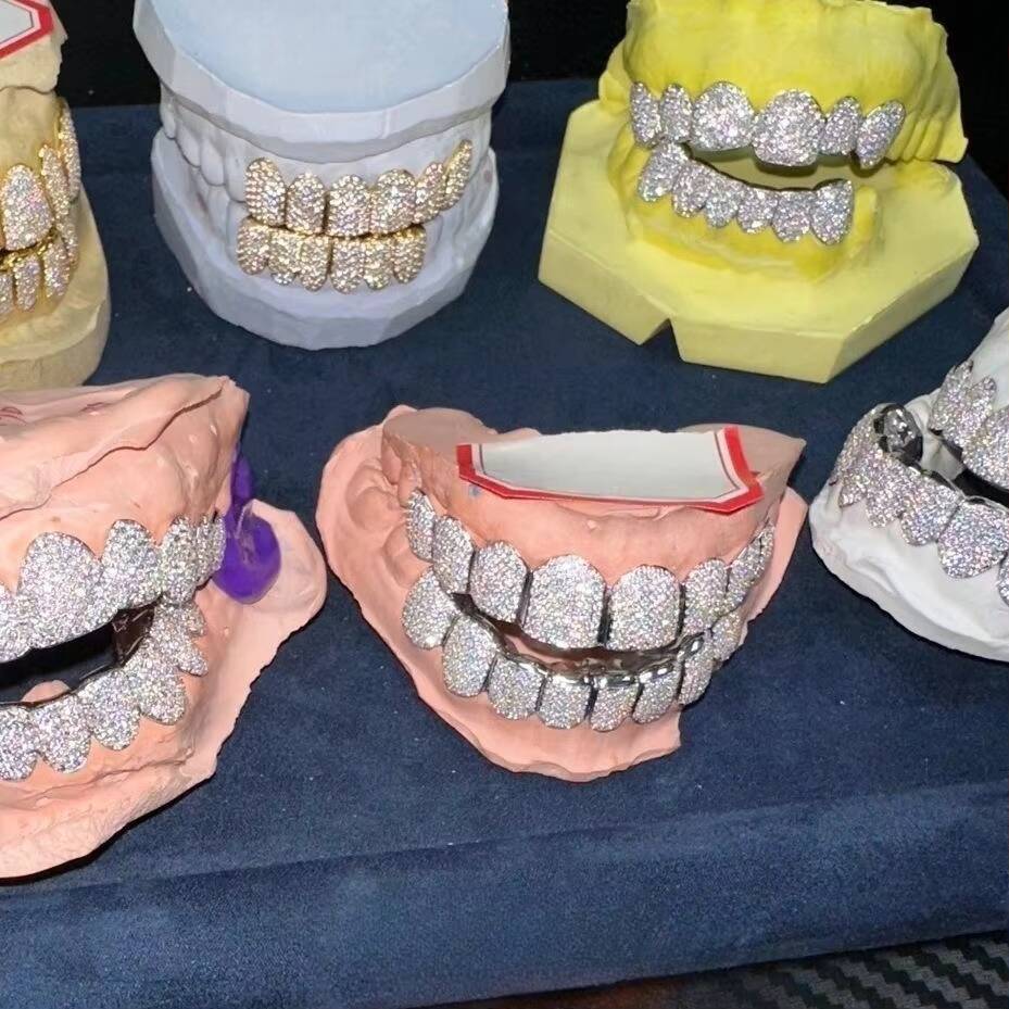 Fashion Hip Hop Jewelry Moissanite Grills Custom Rose Gold Plated 925 Silver Iced Out VVS Moissanite Diamond Teeth Grillz