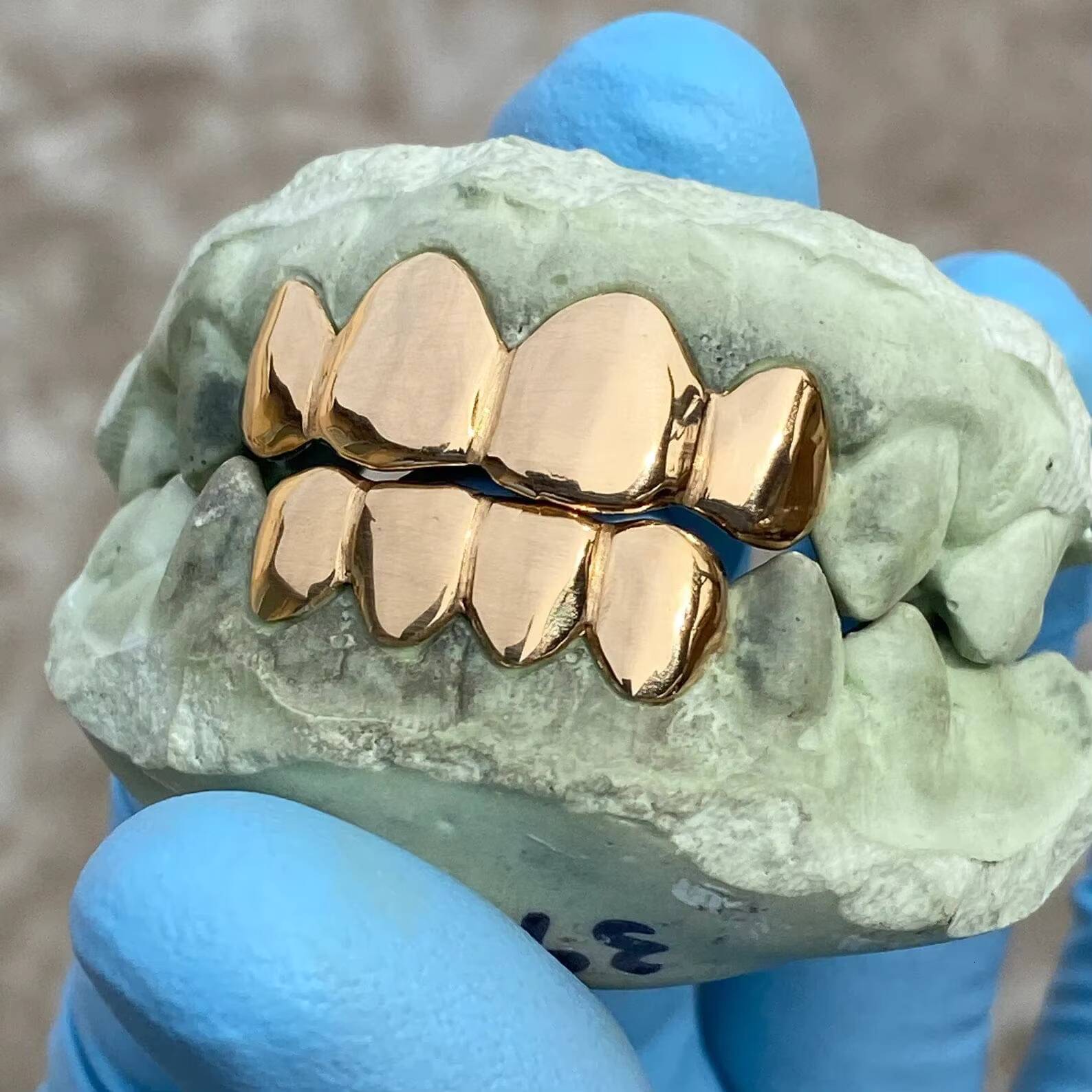 Real Solid 22K Gold Custom Grillz Teeth Grill or Single One Tooth Cap 4 Top and 4 Bottom Moissanite Diamond Teeth Grillz for Men