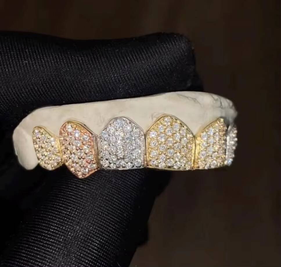 10K VVS Moissanite Grills Large Centre Stones Custom Grillz London Based Perfect Fit 8 Top 8 Bottom Fully Iced Out Grillz