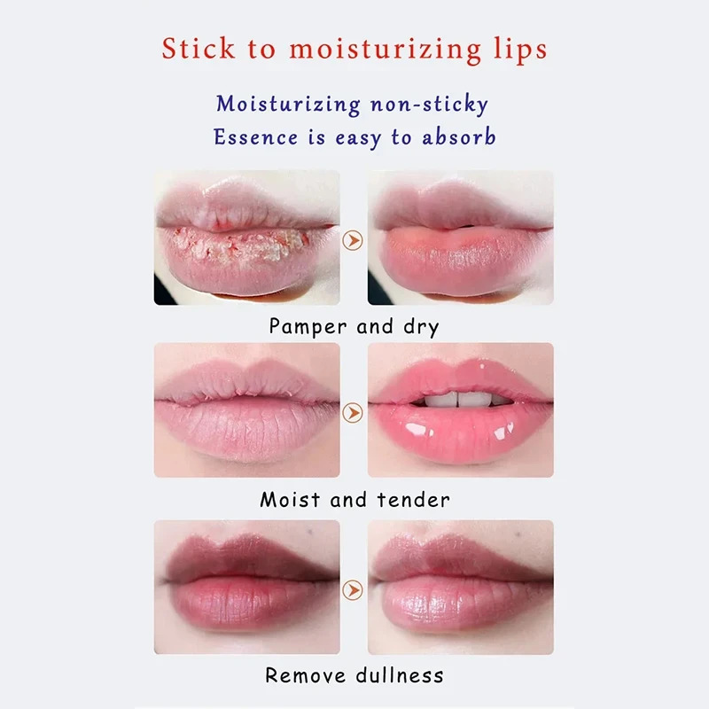 Remove Dark Lighten Lip Balm Exfoliating Dead Skin AntiCrack Fade Line Moisturizing Brighten Repair Care Products 250716
