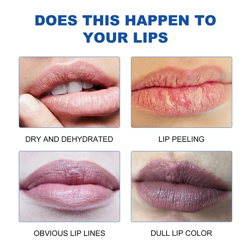 Instantly Lip Balm Dark Lighten Melanin Lip Mask Fade Lip Line Brighten Exfoliating Dead Skin Lip Care 250726