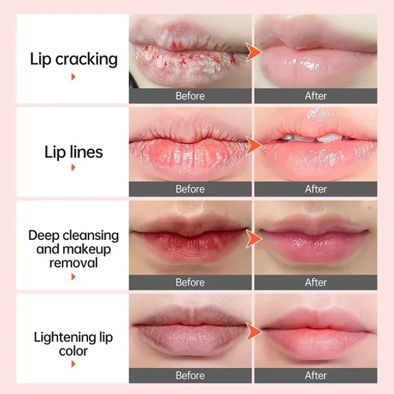Dark Lip Balm Deep Lighten Melanin Mask Gloss Oil Exfoliate Nourish Fade Lip Line Korean Sleep Lipstick 250726