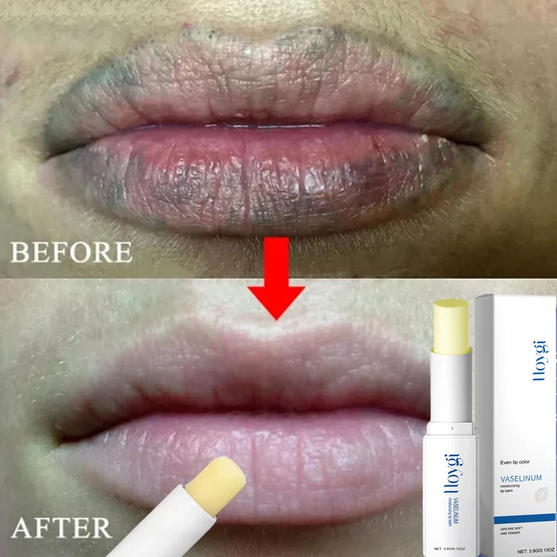Instantly Lip Balm Dark Lighten Melanin Lip Mask Fade Lip Line Brighten Exfoliating Dead Skin Lip Care 250726