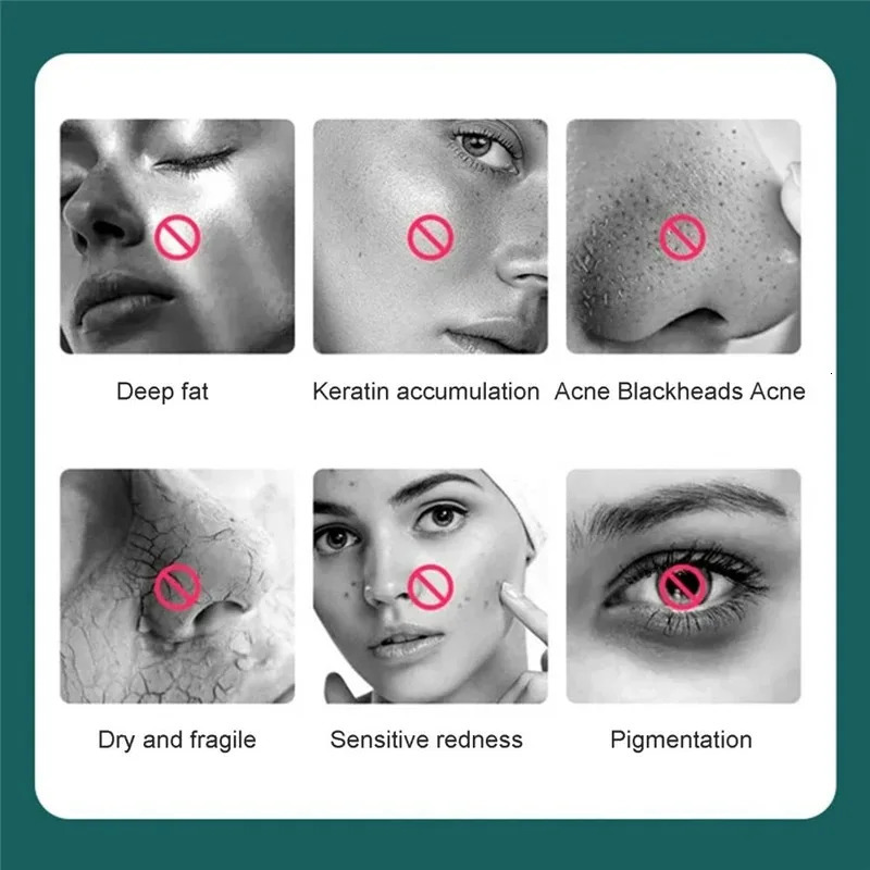 USB Rechargeable Blackhead r Pore Clean Face Wash Skin Electric Facial Silicone Cleansing Brush Vibration Sonic Massager 250726