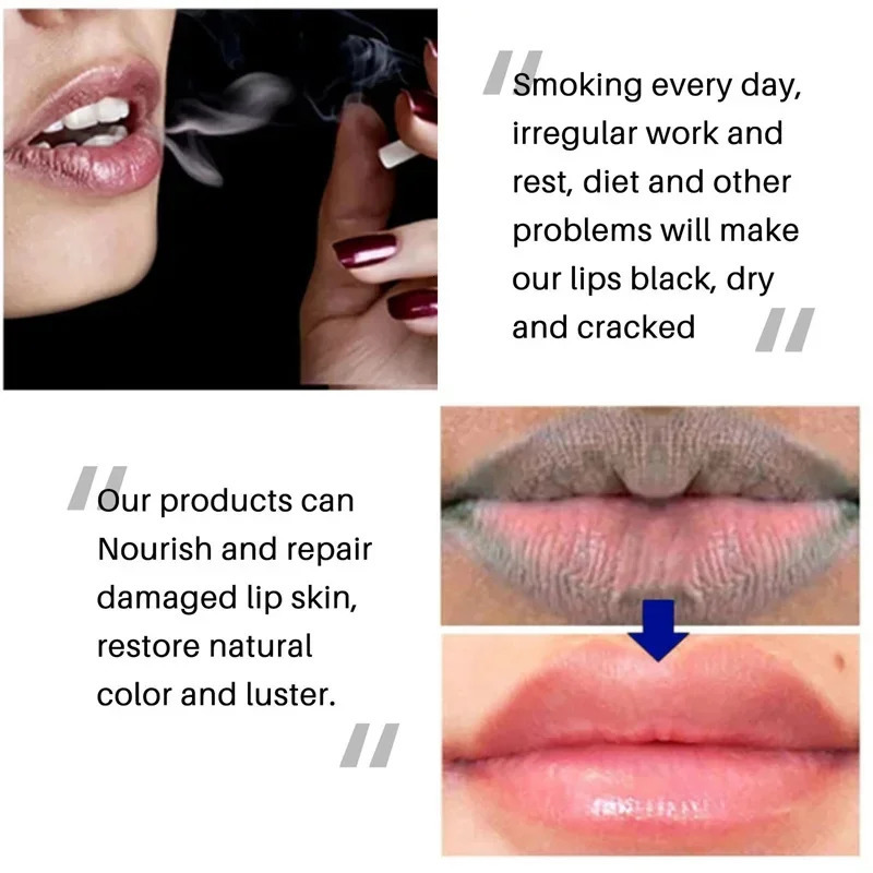 Remove Dark Smoke Lip Balm Melanin Bleaching Gloss Oil Lips Pink Lipstick Exfoliating Fade Lip Lines Korean Cosmetics 250704