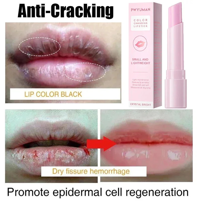 Remove Dark Smoke Lip Balm Melanin Bleaching Gloss Oil Lips Pink Lipstick Exfoliating Fade Lip Lines Korean Cosmetics 250704