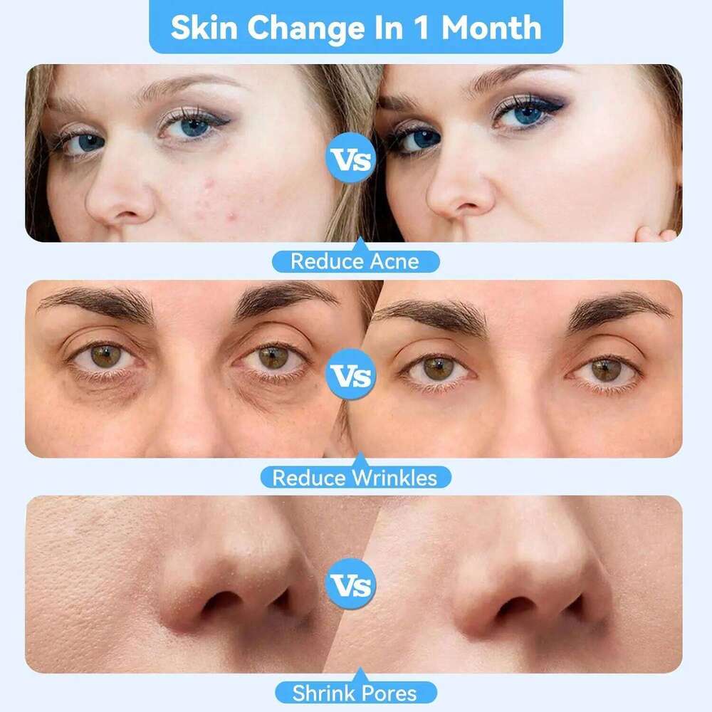 New Handheld Dia Microdermabrasion hine with Spray,Facial Peeling Beauty Device Blackhead Removal Acne Cleaning Tools