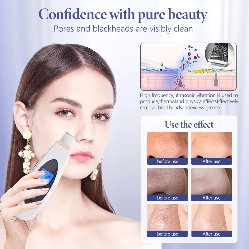 Ultrasonic Skin Scrubber Deep Face Cleaning Machine Facial Massager Ultrasound Peeling Clean Tone Lift LW006 250726