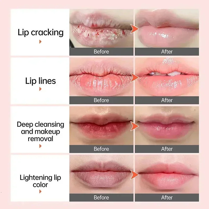 Remove Dark Lip Balm Fast Pink Lip Exfoliating Fade Lip Line Dead Skin Moisturizer Korean Care Products Beauty Health 250704