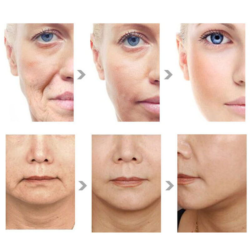 2025 Newest Vmax Wrinkle Removal Non-invasive Anti-aging 4D Body Shaping Skin Tightening Vmax hifu Beauty Device for Home Spa