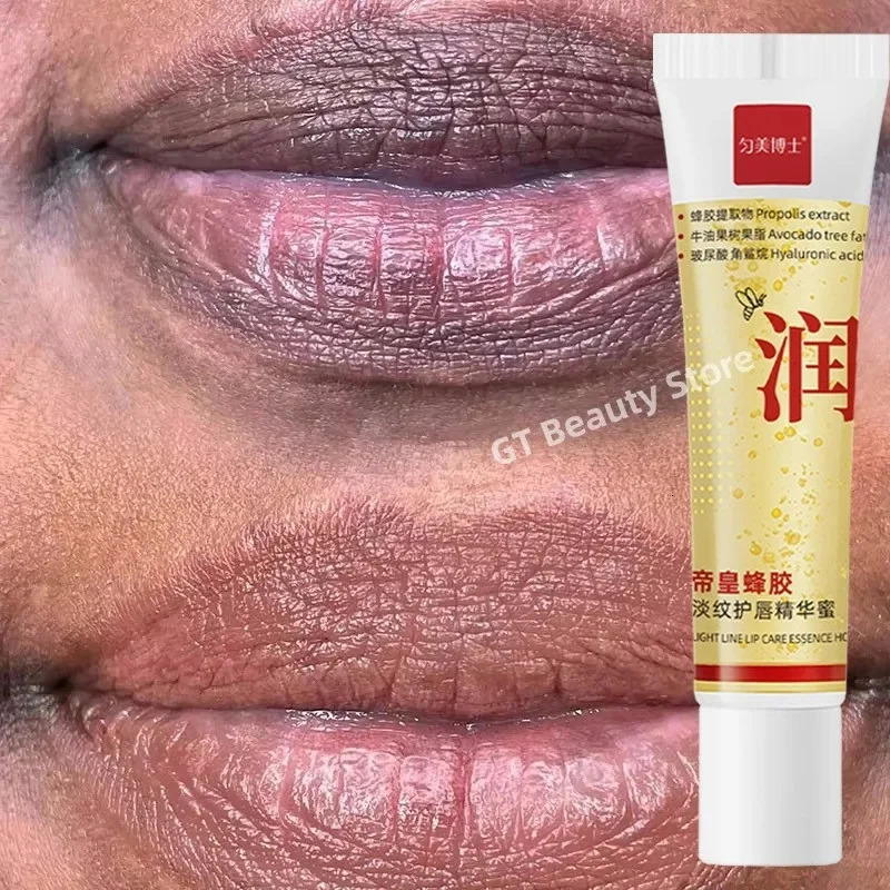 Remove Dark Lip Balm Fast Pink Lip Exfoliating Fade Lip Line Dead Skin Moisturizer Korean Care Products Beauty Health 250704