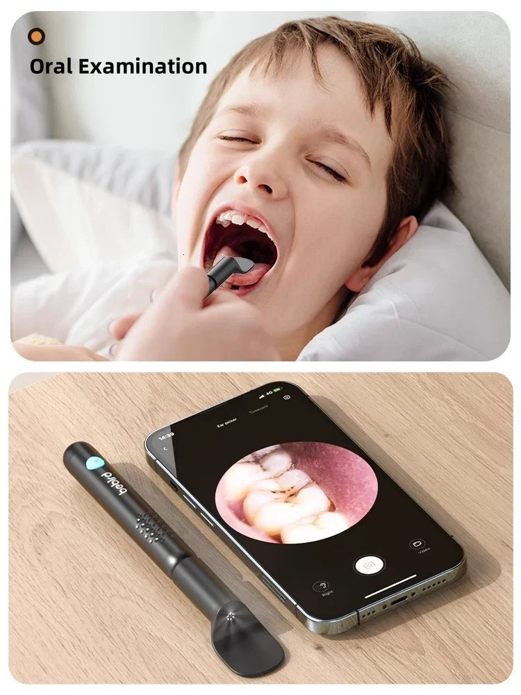 Bebird R3 Ear Cleaner Smart Visual In Ear Wax Removal Tool Cleaning Endoscope Earpick Mini Camera Otoscope Personal Care 250726