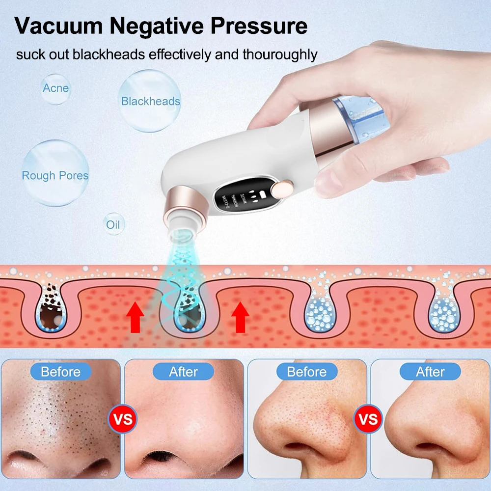 Electric Vacuum Blackhead r Bubble Water Cycle Face Dead Skin Pore Cleansing Suction Blackheads Removal Instrument 250726