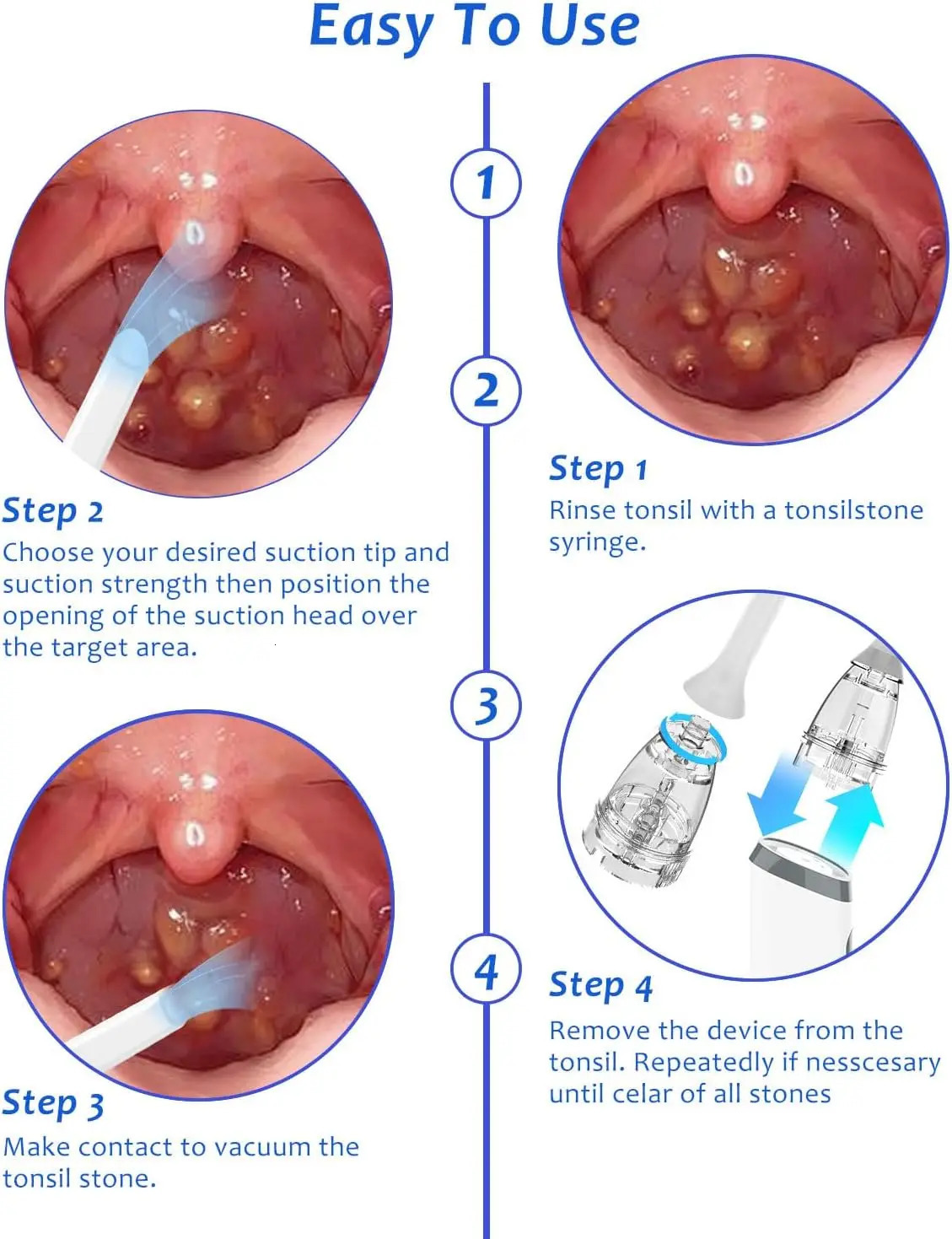 Electronic Vacuum Tonsil Stone r Kit with LED light 8 Suction Modes Bad Breath Oral Fresh Care Tongue Coating Scraper 250726