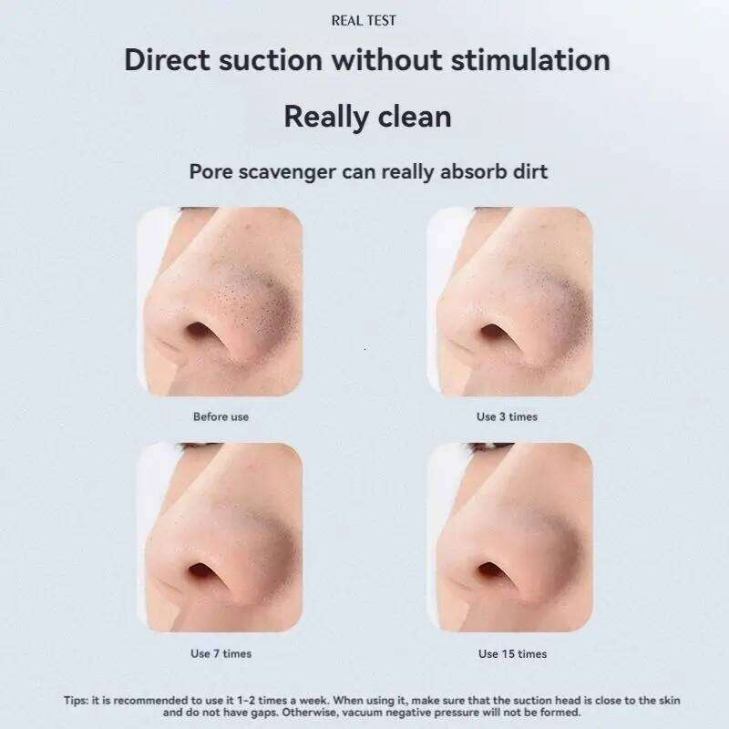 Portable Blackhead Remover Vacuum Pore Acne Cleaner Nose Hot and Cold Compress Face Skin Care Device Home Beauty Instrument