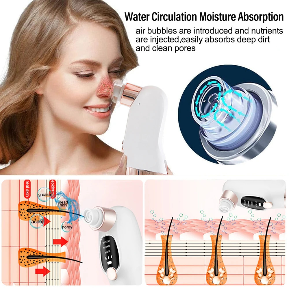 Electric Vacuum Blackhead r Bubble Water Cycle Face Dead Skin Pore Cleansing Suction Blackheads Removal Instrument 250726