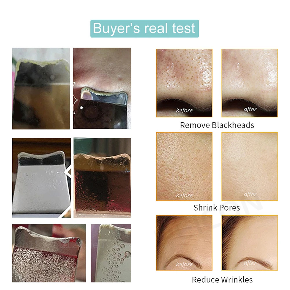 Ultrasonic Skin Scrubber Peeling Blackhead r Deep Face Cleaning Ultrasonic Ion Ance Pore Cleaner Facial Shovel Cleanser 250726