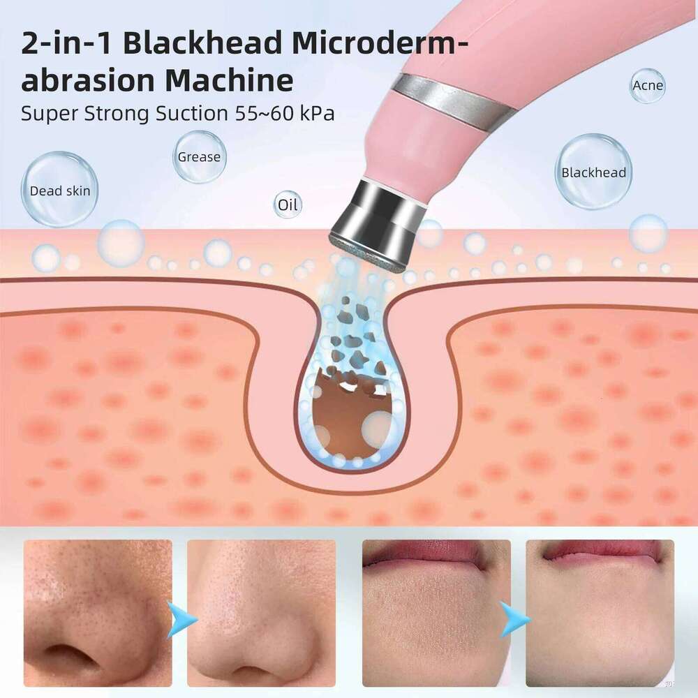 Foreverlily Portable Dia Peeling hine Microdermabrasion Facial Cleaning Device Exfoliation Vacuum Blackhead Remover