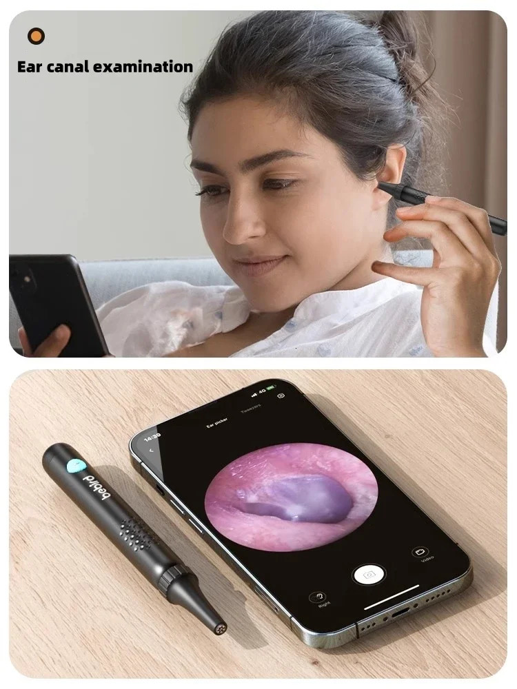 Bebird R3 Ear Cleaner Smart Visual In Ear Wax Removal Tool Cleaning Endoscope Earpick Mini Camera Otoscope Personal Care 250726