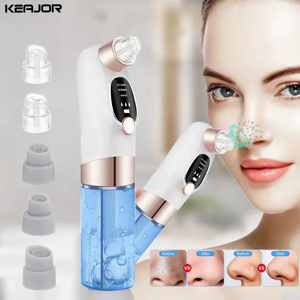 Electric Vacuum Blackhead r Bubble Water Cycle Face Dead Skin Pore Cleansing Suction Blackheads Removal Instrument 250726