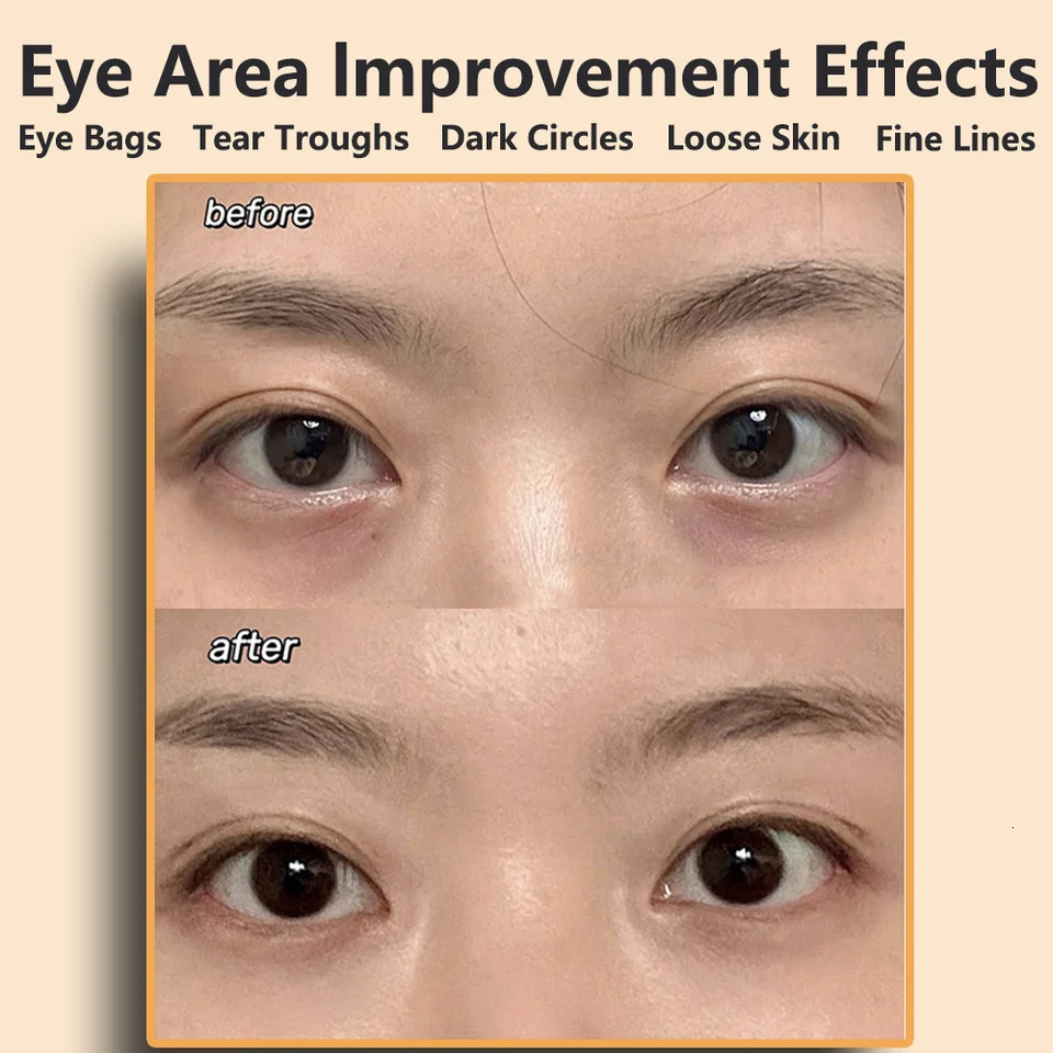 Ems Eye Face Beauty Massage Muscle Stimulator Lifting Anti-Wrinkle Lift Face Skin Care Dark Circles Relieves Fatigue 250725