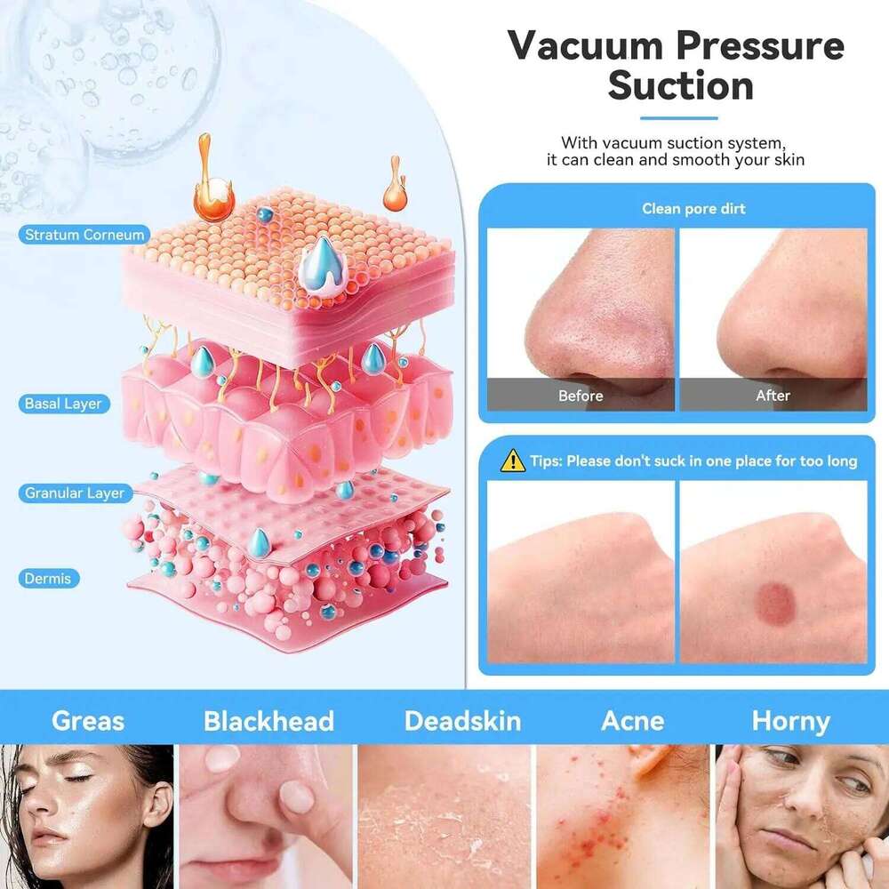 New Handheld Dia Microdermabrasion hine with Spray,Facial Peeling Beauty Device Blackhead Removal Acne Cleaning Tools