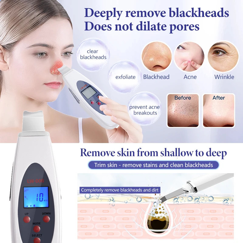 Ultrasonic Skin Scrubber Deep Face Cleaning Machine Facial Massager Ultrasound Peeling Clean Tone Lift LW006 250726