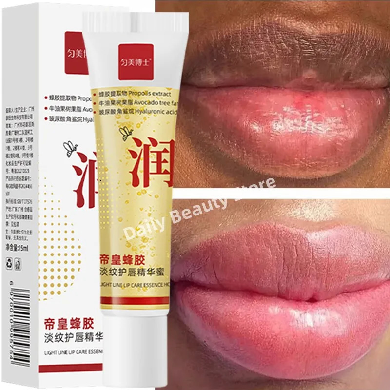 Remove Dark Lip Balm Fast Pink Lip Exfoliating Fade Lip Line Dead Skin Moisturizer Korean Care Products Beauty Health 250704