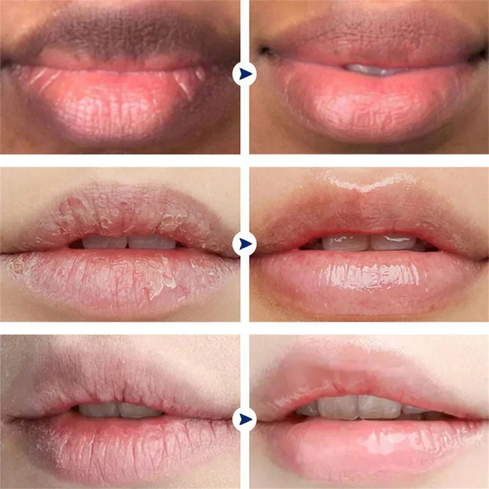 Remove Dark Smoke Lip Balm Melanin Bleaching Gloss Oil Lips Pink Lipstick Exfoliating Fade Lip Lines Korean Cosmetics 250704