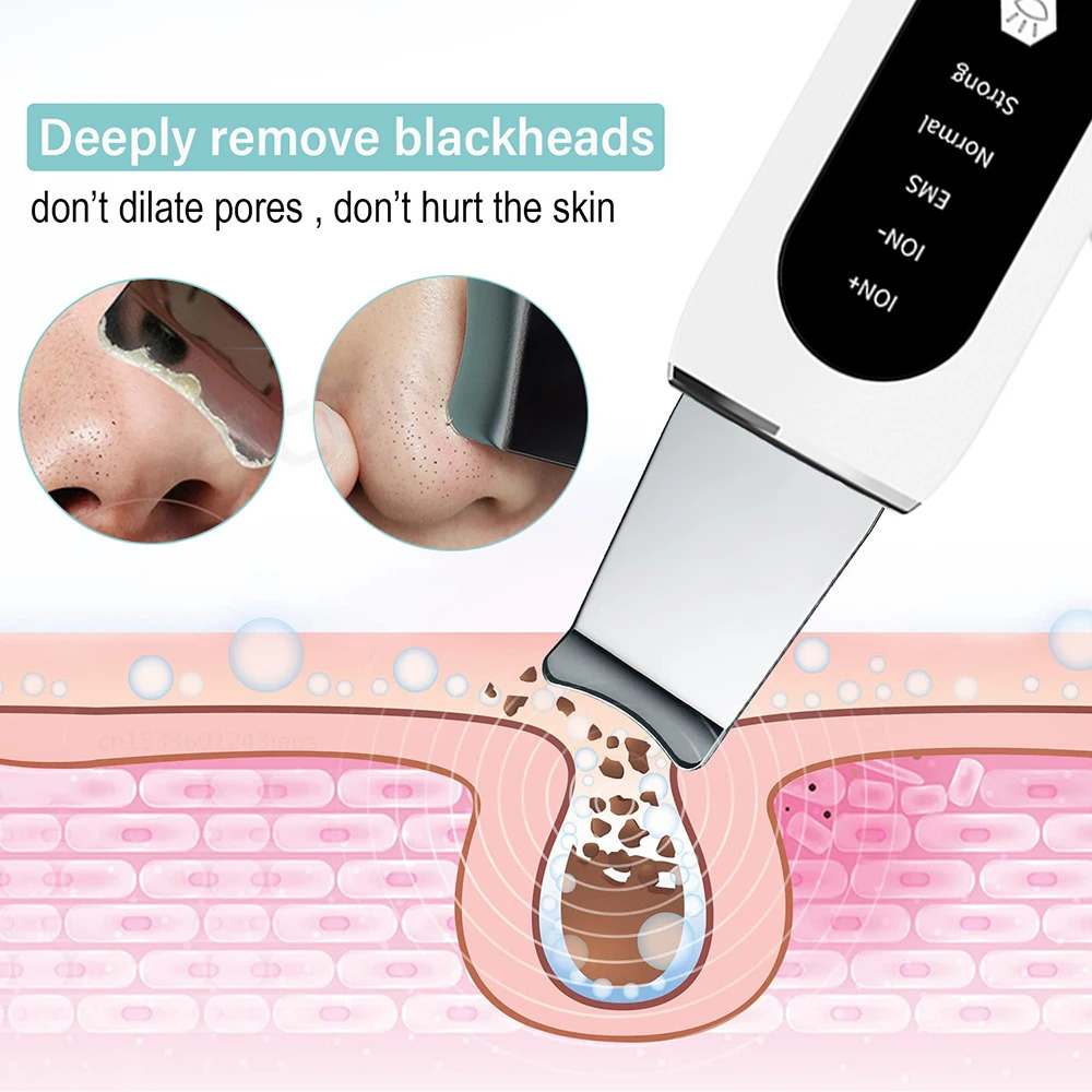 Ultrasonic Skin Scrubber Peeling Blackhead r Deep Face Cleaning Ultrasonic Ion Ance Pore Cleaner Facial Shovel Cleanser 250726