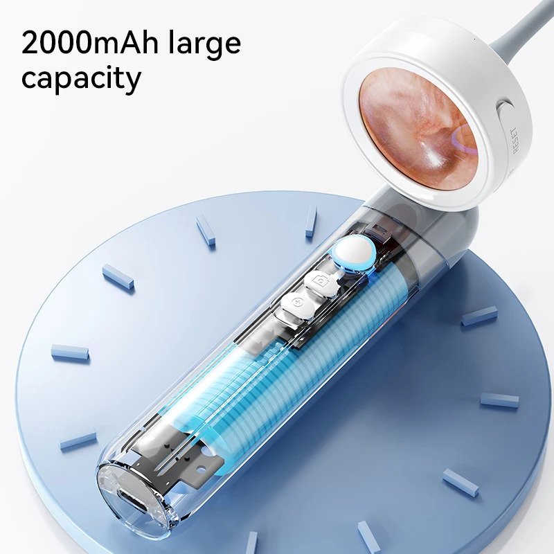 Visual Ear Camera 3.2mm Lens 1080P HD Ear Mouth Nose Check with 4 Lights for Kids and Adults Pets Support Take Po Connect PC 250726