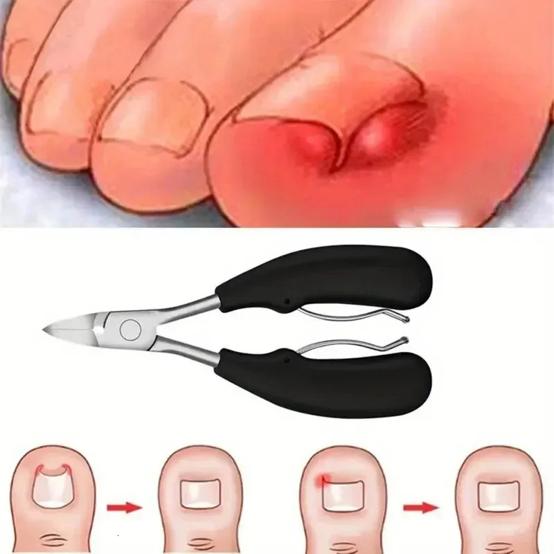 Ingrown Toenail Thick Nail Clipper Set Heavy-Duty Podiatrist Grade Nail Cutter Dead Skin r Manicure Pedicure Nail Tools 250729