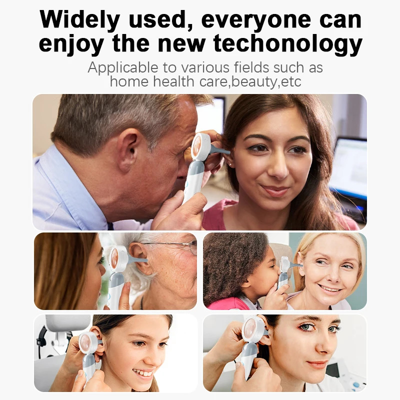 Visual Ear Camera 3.2mm Lens 1080P HD Ear Mouth Nose Check with 4 Lights for Kids and Adults Pets Support Take Po Connect PC 250726