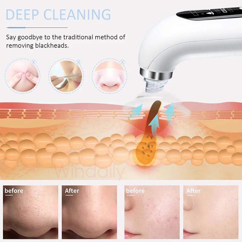 2025 Blackhead Remover Pore Vacuum Cleaner Electric Micro Small Bubble Cleasing Machine USB Rechargeable Beauty Device 250729