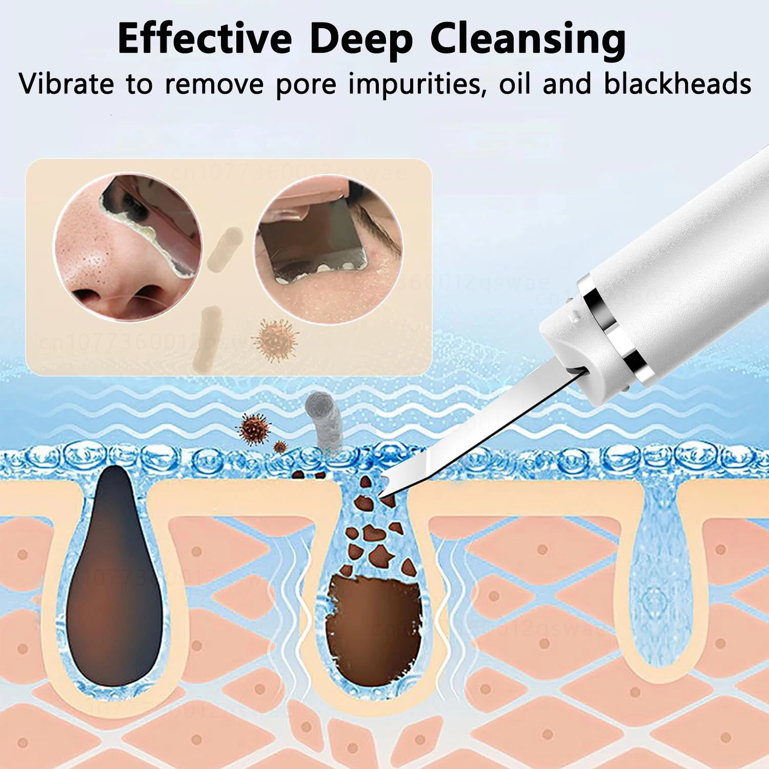 Ultrasonic Skin Scrubber Facial Deep Cleansing Blackhead Ultrasonic Cleansing Cavitation Peeling Shovel Skin Scrubber 251030