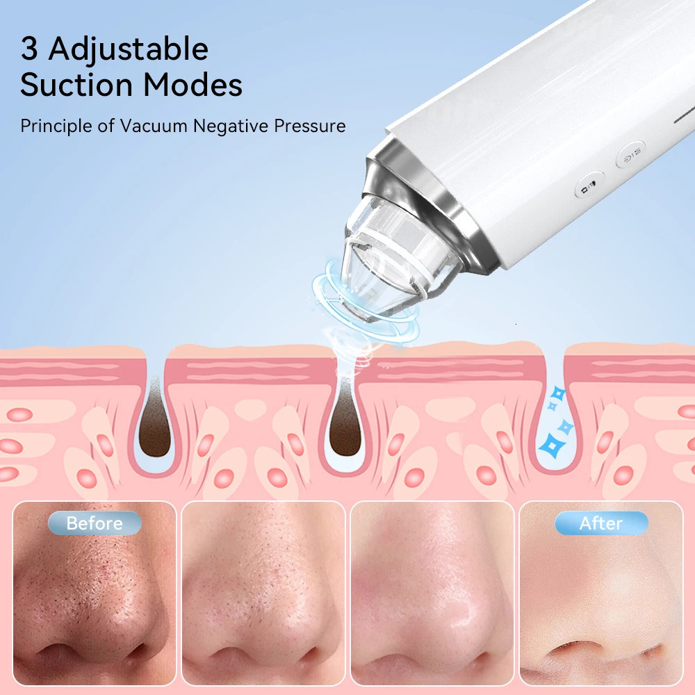 Vacuum Cleaner Electric Blackhead r Black Head Removal Facial Deep Cleansing Pore Cleaner Machine Skin Care Tools 251030