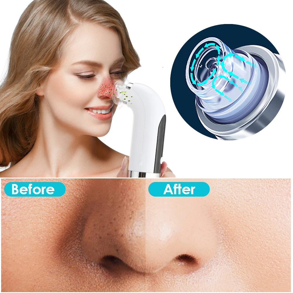 Blackhead r Pore Cleaner Vacuum Suction r Pimple Black Dot Removal Facial Cleaning Beauty Tools Face Skin Care 251030