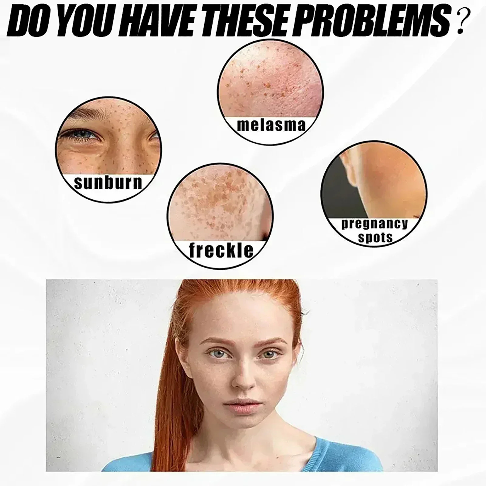 Freckle Cream Effectively reduces Brightens and revitalizes dull skin Hydrates and nourishes the skin 251030