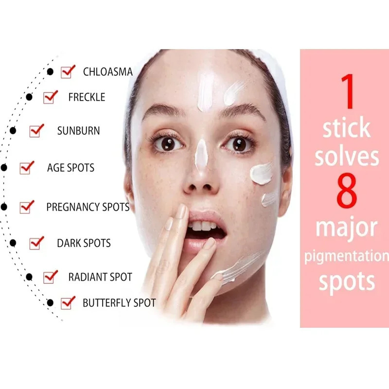 Freckle Cream Effectively reduces Brightens and revitalizes dull skin Hydrates and nourishes the skin 251030