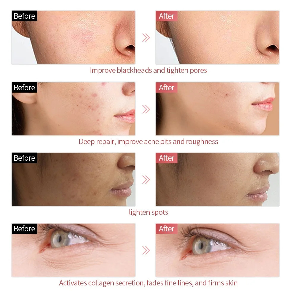 7 Colors LED Face Beauty Machine Red Light Skin Care Led Mask Home Use Devices Skin Tighten Rejuvenation Facial Mask 251030