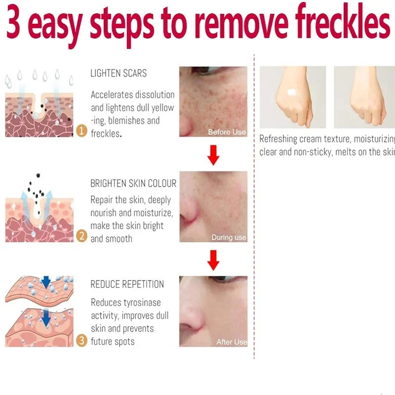 Freckle Cream Effectively reduces Brightens and revitalizes dull skin Hydrates and nourishes the skin 251030
