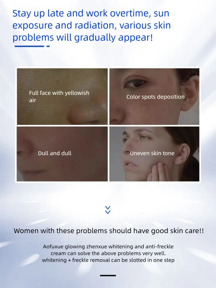 Freckles Cream Melasma Corrector Lighten Melanin Pigmentation Skin 251030