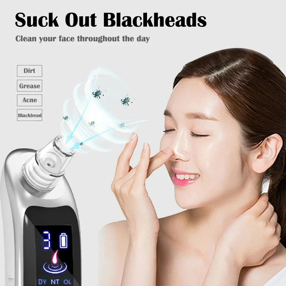 ZJM0001 Facial Blackhead and Removal Cleaner Electric Blackhead Removal Tool Facial Vacuum Cleaner 251030