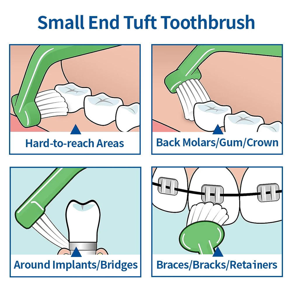 5 orthodontic toothbrushes interdental brushes single beam soft hair flat head dental cleaning and oral hygiene tools 250325