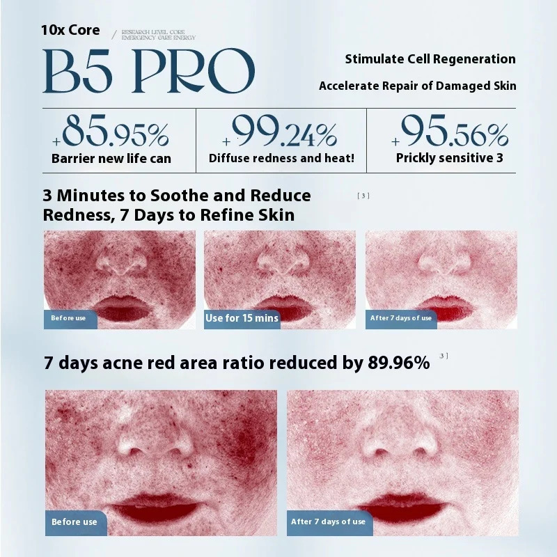 Ruyi B5 Skin Care Set 34pcs Oil Control Deep Clean Facial Cleanser r Toner Face Cream Gift Box Skin Care Men Women 251030